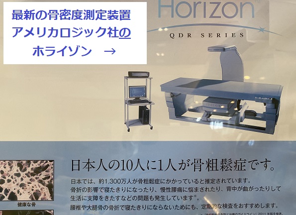 骨密度測定装置ホライゾン